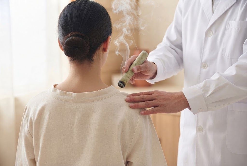 Moxibustion treatment at Sin An Tang